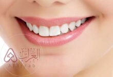 افضل دكتور اسنان بجدة تأمين ممتاز