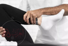 ما هو التصلب الضموري العضلي الجانبي ويكيبيديا